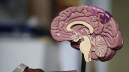 Covid-19 linked with Alzheimer's disease-like cognitive impairment: Study. Photo : Hindustan Times